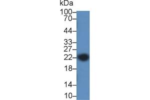 Detection of CAV1 in Mouse Colon lysate using Polyclonal Antibody to Caveolin 1 (CAV1)