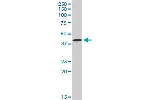 CA12 MaxPab rabbit polyclonal antibody. (CA12 anticorps  (AA 1-354))
