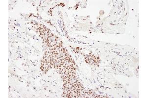 Immunohistochemistry (IHC) image for anti-E1A Binding Protein P300 (EP300) (AA 950-1000) antibody (ABIN7448706)