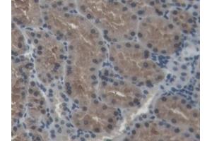 Detection of SOD1 in Porcine Kidney Tissue using Polyclonal Antibody to Superoxide Dismutase 1 (SOD1) (SOD1 anticorps  (AA 2-153))