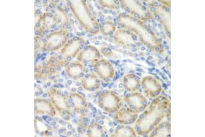 Immunohistochemistry of paraffin-embedded rat kidney using ASPSCR1 antibody (ABIN5975297) at dilution of 1/100 (40x lens). (ASPSCR1 anticorps)
