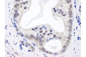 Immunohistochemistry (IHC) image for anti-Casein kappa (CSN3) (AA 325-375) antibody (ABIN7448493) (CSN3 anticorps  (AA 325-375))