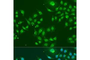 Immunofluorescence analysis of U2OS cells using IFIT3 Polyclonal Antibody at dilution of 1:100. (IFIT3 anticorps)
