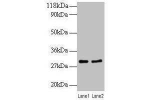Western blot All lanes: RPL8 antibody at 2 μg/mL Lane 1: EC109 whole cell lysate Lane 2: 293T whole cell lysate Secondary Goat polyclonal to rabbit IgG at 1/10000 dilution Predicted band size: 29 kDa Observed band size: 29 kDa (RPL8 anticorps  (AA 3-257))