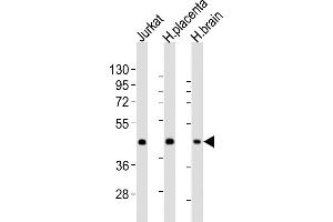 All lanes : Anti-WNT2 Antibody (Center) at 1:2000 dilution Lane 1: Jurkat whole cell lysates Lane 2: human placenta lysates Lane 3: human brain lysates Lysates/proteins at 20 μg per lane. (WNT2 anticorps  (AA 254-287))