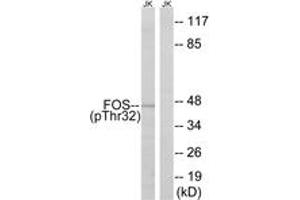 Western blot analysis of extracts from Jurkat cells treated with starved 24h, using FOS (Phospho-Ser32) Antibody. (c-FOS anticorps  (pSer32))