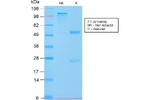 SDS-PAGE Analysis Purified CK20 Recombinant Rabbit Monoclonal Antibody (KRT20/3129R). (Recombinant KRT20 anticorps  (AA 196-323))