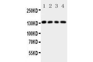Western Blotting (WB) image for anti-Laminin, gamma 2 (LAMC2) (AA 1160-1180), (C-Term) antibody (ABIN3043156) (LAMC2 anticorps  (C-Term))