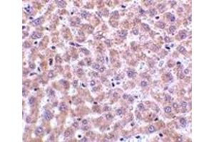 Immunohistochemistry (IHC) image for anti-Perilipin 3 (PLIN3) (N-Term) antibody (ABIN1031617)