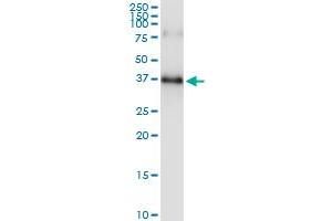 Immunoprecipitation of SPRY1 transfected lysate using anti-SPRY1 MaxPab rabbit polyclonal antibody and Protein A Magnetic Bead , and immunoblotted with SPRY1 purified MaxPab mouse polyclonal antibody (B01P) .
