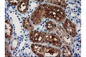 Image no. 1 for anti-Aminoacylase 3 (ACY3) antibody (ABIN1496464) (Aminoacylase 3 anticorps)