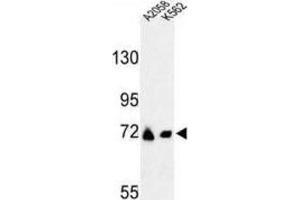 Western Blotting (WB) image for anti-Glutamine-Fructose-6-Phosphate Transaminase 2 (GFPT2) antibody (ABIN3004112) (GFPT2 anticorps)