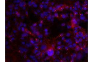 Immunofluorescence (IF) image for anti-Integrin alpha V, Integrin beta 3 (ITGAV/ITGB3) antibody (ABIN2664760) (CD51/CD61 anticorps)