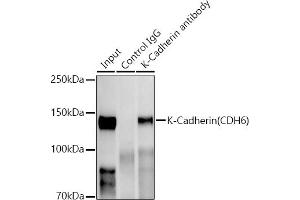 Immunoprecipitation analysis of 300 μg extracts of HepG2 cells using 3 μg K-Cadherin (CDH6) antibody (ABIN1680831, ABIN3019147, ABIN3019148 and ABIN7101722). (CDH6 anticorps)