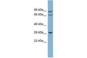 WB Suggested Anti-CUTC Antibody Titration: 0. (CUTC anticorps  (Middle Region))
