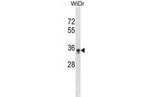 Western Blotting (WB) image for anti-Phosphatidylinositol Glycan L (PIGL) antibody (ABIN2999037) (PIGL anticorps)
