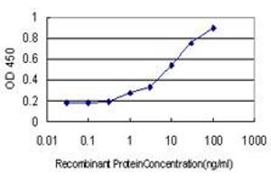 anti-Differentially Expressed in FDCP 6 Homolog (DEF6) (AA 1-336) antibody