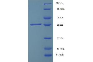 SDS-PAGE (SDS) image for Single-Strand-Selective Monofunctional Uracil-DNA Glycosylase 1 (SMUG1) (AA 1-177), (full length) protein (His-SUMO Tag) (ABIN5711385) (SMUG1 Protein (AA 1-177, full length) (His-SUMO Tag))