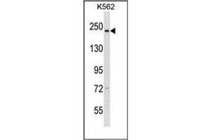 Western blot analysis of CAPD3 Antibody (C-term) in K562 cell line lysates (35ug/lane). (NCAPD3 anticorps  (C-Term))