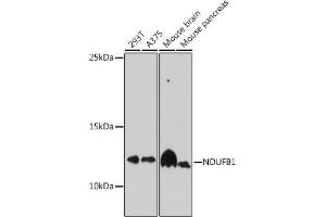 Western blot analysis of extracts of various cell lines, using NDUFB1 antibody (ABIN7268808) at 1:1000 dilution. (NDUFB1 anticorps  (AA 1-105))