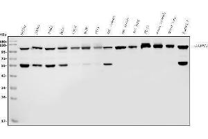 Western blot analysis of ANAPC2 using anti-ANAPC2 antibody (ABIN7601930). (ANAPC2 anticorps  (AA 51-272))