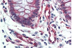 Human Colon (formalin-fixed, paraffin-embedded) stained with SERPINH1 antibody ABIN364502 at 5 ug/ml followed by biotinylated anti-mouse IgG secondary antibody ABIN481714, alkaline phosphatase-streptavidin and chromogen. (SERPINH1 anticorps)
