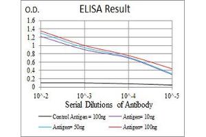 Black line: Control Antigen (100 ng), Purple line: Antigen(10 ng), Blue line: Antigen (50 ng), Red line: Antigen (100 ng),