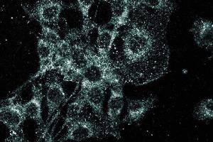 Immunofluorescence staining of RSV-3T3 cells.