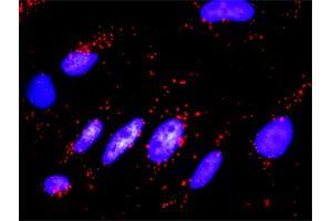 Proximity Ligation Analysis of protein-protein interactions between FADD and EZR.