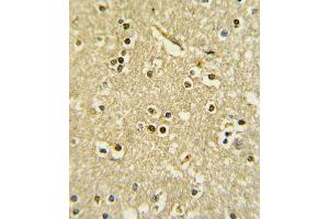 Formalin-fixed and raffin-embedded human brain tissue with X6 Antibody (Center), which was peroxidase-conjugated to the secondary antibody, followed by DAB staining.