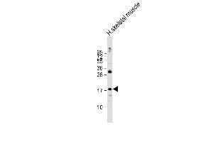 Anti-ND4L Antibody (C-term) at 1:2000 dilution + human skeletal muscle lysate Lysates/proteins at 20 μg per lane.