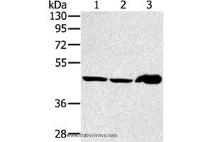 Western blot analysis of Mouse liver tissue and PC3 cell, human fetal liver tissue, using SEC14L2 Polyclonal Antibody at dilution of 1:400 (SEC14L2 anticorps)