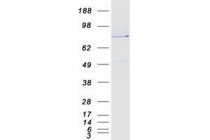 Validation with Western Blot