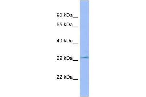 WB Suggested Anti-Lhpp Antibody Titration: 1. (LHPP anticorps  (C-Term))