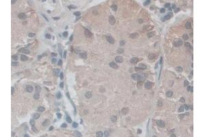 IHC-P analysis of Human Stomach Tissue, with DAB staining.