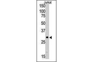 Western blot analysis of SIRT5 polyclonal antibody  in Jurkat cell lysate (35 ug/lane). (SIRT5 anticorps  (C-Term))