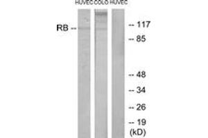 Western blot analysis of extracts from HuvEc/COLO cells, using Retinoblastoma (Ab-795) Antibody. (Retinoblastoma Protein (Rb) anticorps  (AA 761-810))