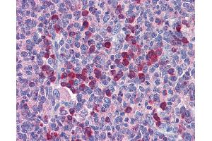 Anti-ROBO2 antibody IHC of human tonsil.