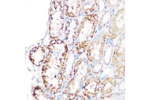 Immunohistochemistry of paraffin-embedded mouse kidney using GLUD1 Rabbit mAb (ABIN7267411) at dilution of 1:100 (40x lens).