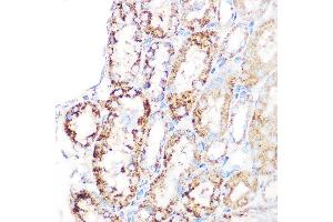Immunohistochemistry of paraffin-embedded mouse kidney using GLUD1 Rabbit mAb (ABIN7267411) at dilution of 1:100 (40x lens). (GLUD1 anticorps)