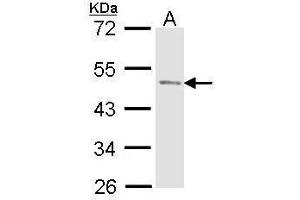 WB Image Sample (30 ug of whole cell lysate) A: Molt-4 , 10% SDS PAGE antibody diluted at 1:1000 (ACPP anticorps)