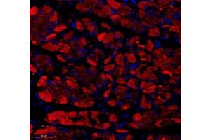 Immunofluorescence of paraffin embedded human stomach using KCTD19 (ABIN7075147) at dilution of 1: 500 (300x lens) (KCTD19 anticorps)