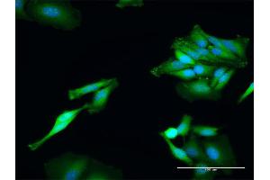 Immunofluorescence of purified MaxPab antibody to TXNRD1 on HeLa cell.