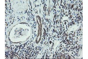 Image no. 11 for anti-NADH Dehydrogenase (Ubiquinone) 1 beta Subcomplex, 10, 22kDa (NDUFB10) antibody (ABIN1499668)