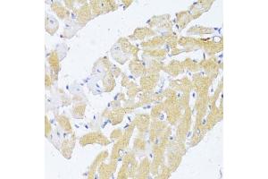 Immunohistochemistry of paraffin-embedded rat heart using N antibody (ABIN6132387, ABIN6144378, ABIN6144379 and ABIN6216511) at dilution of 1:100 (40x lens).