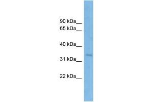 WB Suggested Anti-SSR1 Antibody Titration: 0. (SSR1 anticorps  (Middle Region))