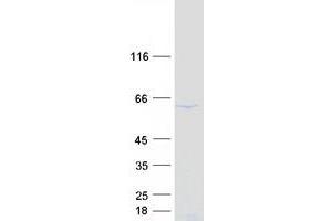 Validation with Western Blot