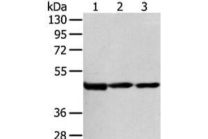 Western Blot analysis of Hela cell and Human bladder carcinoma tissue, Human normal liver tissue using AGPAT9 Polyclonal Antibody at dilution of 1/200 (AGPAT9 anticorps)