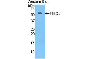 Western blot analysis of the recombinant protein. (Thymidine Phosphorylase anticorps  (AA 33-290))