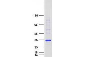 Validation with Western Blot